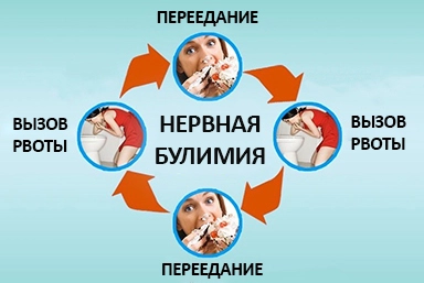 Лечение булимии в Покачах